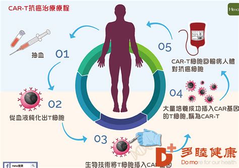 日本免疫细胞 Car T免疫疗法治疗过程多睦健康海外高端医疗