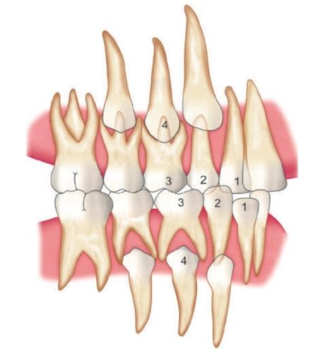 Serial Extraction Dental By Hadeel المسلسل من هديل 🕊 Hadeel7m رتبها