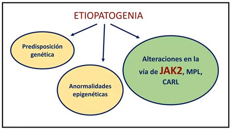 Neoplasias Mieloproliferativas Phi PPT