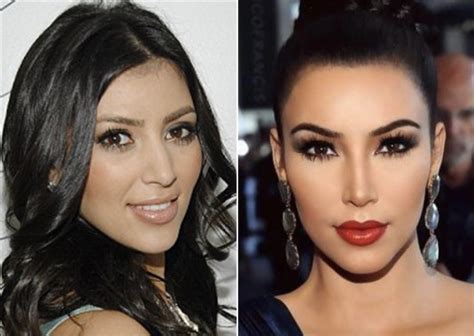 Kim before and after 3 - The Hollywood Gossip