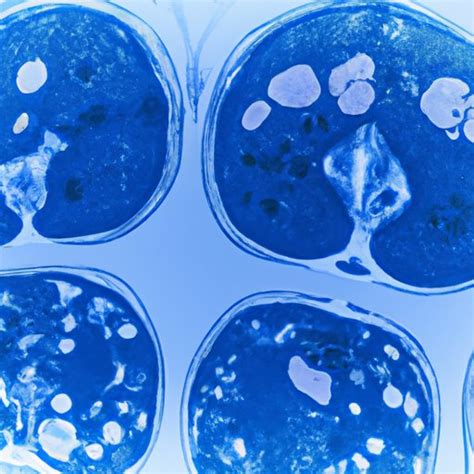 How to Get Rid of Radiation After CT Scan: Tips for Reducing Exposure ...