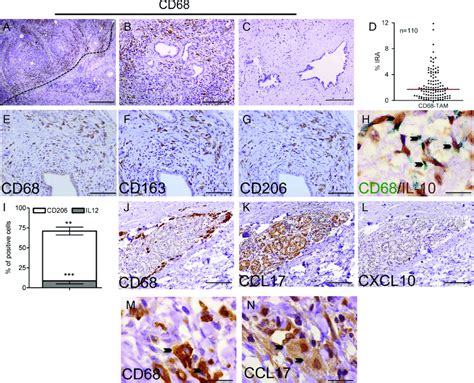 Cd68 Tams At The Tumour Stroma Interface Display An Immunosuppressive Download Scientific