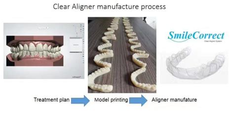 How We Make Clear Aligner Works China Orthodontic