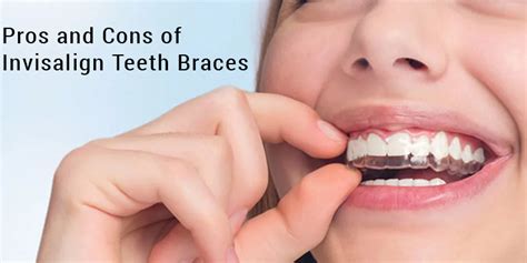 Pros And Cons Of Invisalign Teeth Braces ﻿dr Bhutani Dental Clinic In