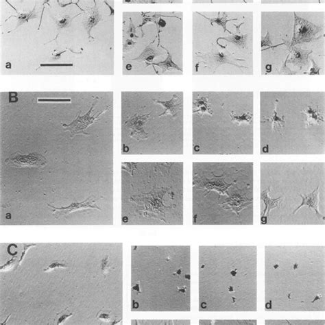 Phase Contrast Microscopy Ofattachment And Spreading Ofb16f10 Melanoma Download Scientific