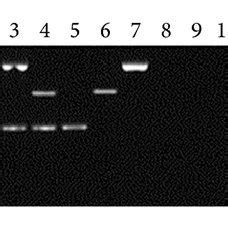 Interaction Effect Of Multiplex PCR Primers M DL2000 DNA Marker 1