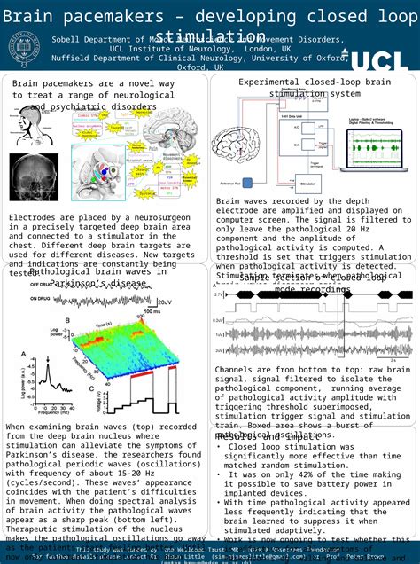 PPT Brain Pacemakers Developing Closed Loop Stimulation Sobell