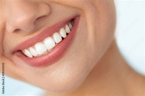 Closeup Of Beautiful Smile With White Teeth Woman Mouth Smiling High