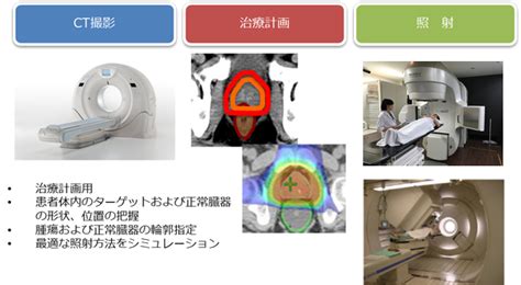 放射線品質管理室 国立がん研究センター 東病院