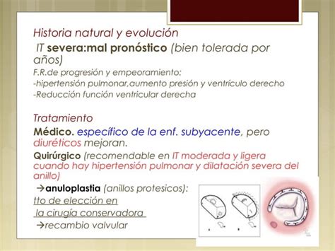 Valvulopat A Mitral Y Tric Spide Ppt