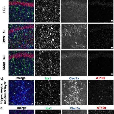 Only Tau Oligomers Induce Rod Like And Clec7a Positive Microglia After