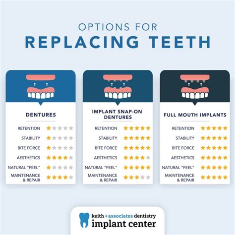 Teeth Replacement Options Keith Associates Kansas City