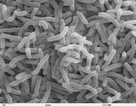 File:Cholera bacteria SEM.jpg - Wikimedia Commons