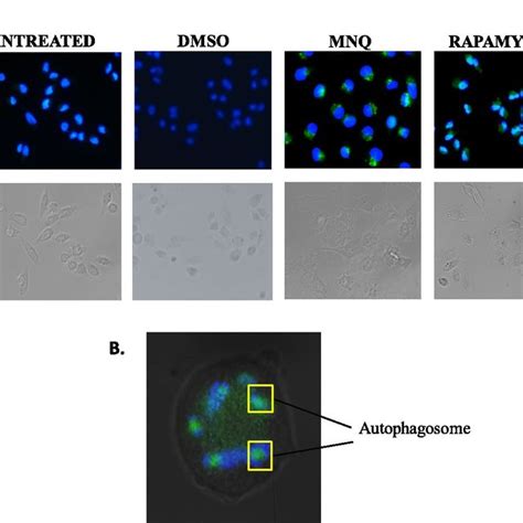 The Autophagic Activity In Mda Mb 231 Cells Treated With Mnq For 24