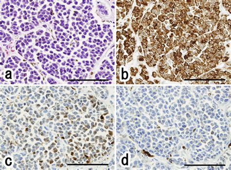 Figure2histological Assessment Of The Metastatic Liver Tumor