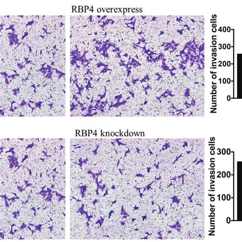 Ihc Analysis Of Rbp4 Expression In The Placenta Example Of