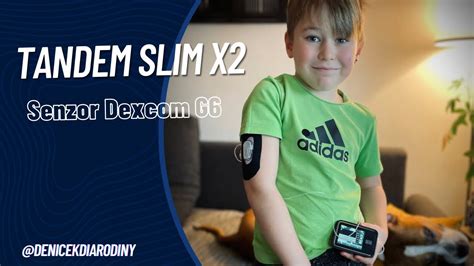 Nasazen Inzul Nov Pumpy Tandem Senzor Dexcom G Youtube