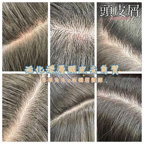 頭皮屑很多怎麼辦 敏感頭皮護理~到【居髮廊 Hair Salon 板橋店】改善頭皮屑【活化深層頭皮去角質 800】~ 妝漂亮版