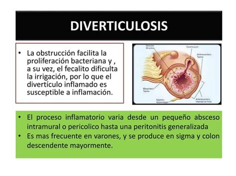 Enfermedad Diverticular Ppt