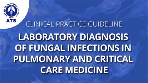 New Guideline For Diagnosing Fungal Infections Youtube