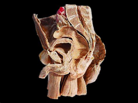 Median Saggital Section Of Male Plevis Plastinated Specimens Male Plevis Atonamical Model