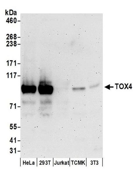 Tox4 Polyclonal Antibody A304 873a