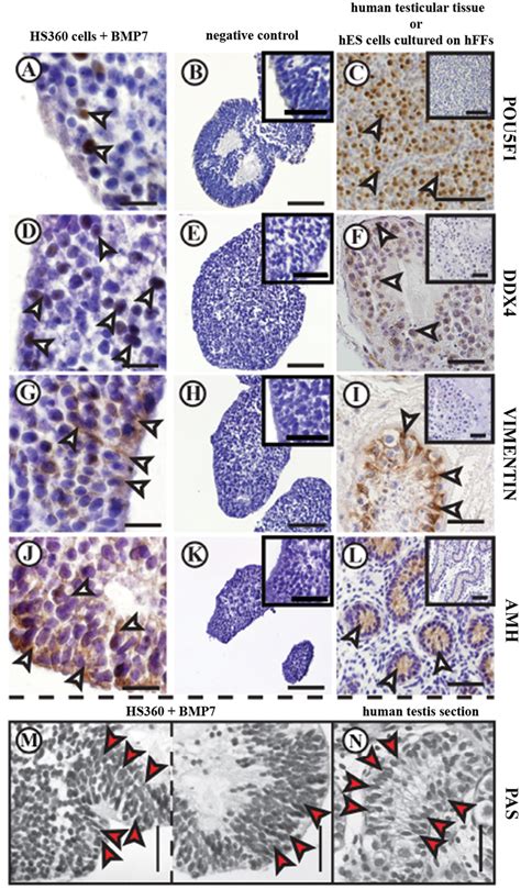 Immunohistochemical Detection Of Pou5f1 Ddx4 Vim And Amh In Human