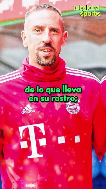 El Origen De La Cicatriz De Franck Ribéry Youtube