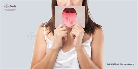 Burning Mouth Syndrome Causes Symptoms And Treatments