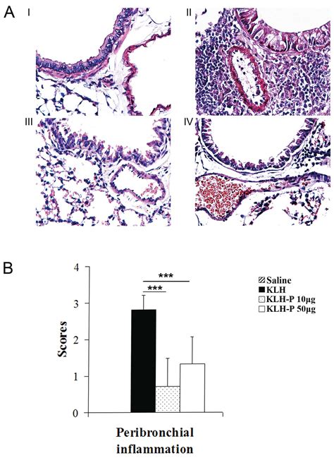 Interleukin Peptide Kinoid Vaccination Attenuates Allergic