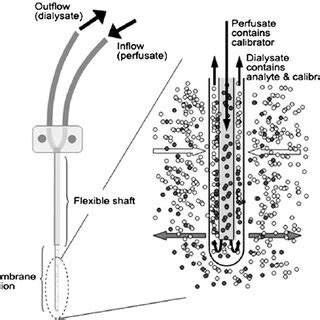 A microdialysis probe of concentric design is shown. | Download ...