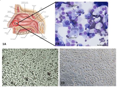 Pnecs Obtained From Nasal Brushings Are True Representatives Of