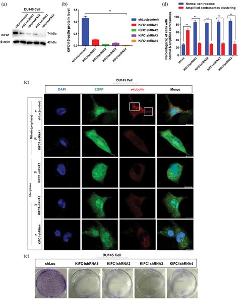 KIFC1 Overexpression Promotes Prostate Cancer Cell Survival And