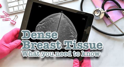 What You Need To Know About Dense Breast Tissue Mega Doctor News