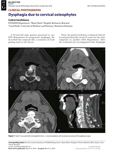 Pdf Dysphagia Due To Cervical Osteophytes