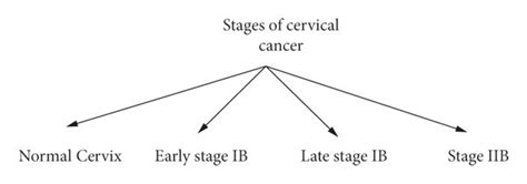 Different stages of cervical cancer. | Download Scientific Diagram