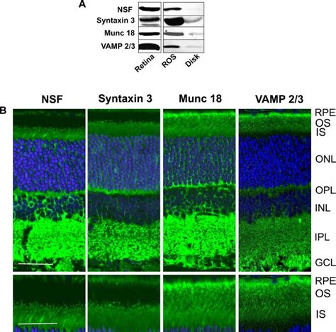 Detection And Localization Of Snare Proteins In The Retina And Ross A