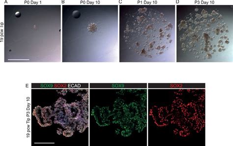 Figures and data in Human embryonic lung epithelial tips are ... 