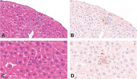 Assessment Of Mouse Liver Histopathology Following Exposure To HFPO DA