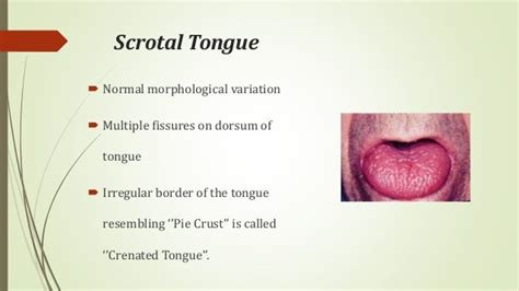 Diseases of lips & tongue