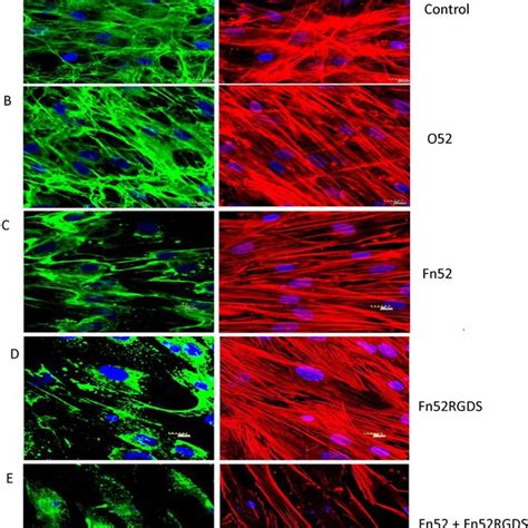 Evaluation Of Fibronectin Matrix Deposition And F Actin Stress Fiber