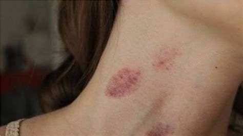 How To Give A Fake Hickey Naturally In 30 Seconds Youtube