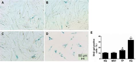 Effects Of Tp On Cellular Morphology And Sa Gal Staining Of Hgmcs