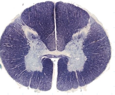 Spinal Cord Anatomy Rexed Areas Diagram Quizlet