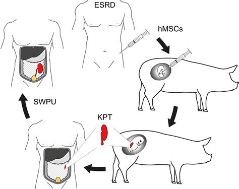 Pigs Pave A Way To De Novo Formation Of Functional Human Kidneys Pnas