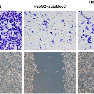 The migration and invasion of HepG2 cells in different groups (×400). | Download Scientific Diagram