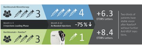 Navilas S Prime Laser R Tine Multispot Navigation