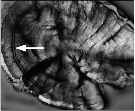 Lutjanus Griseus Sagittal Otolith Polished In The Sagittal Plane