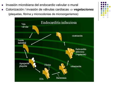 Tema Bacteriemia Y Endocarditis Infecciosa Ppt