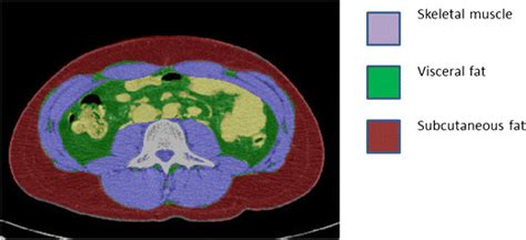 Subcutaneous Fat Visceral Fat And Skeletal Muscle As Depicted On An Download Scientific